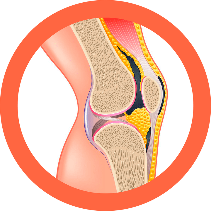 Hondroten restaure les articulations et les muscles